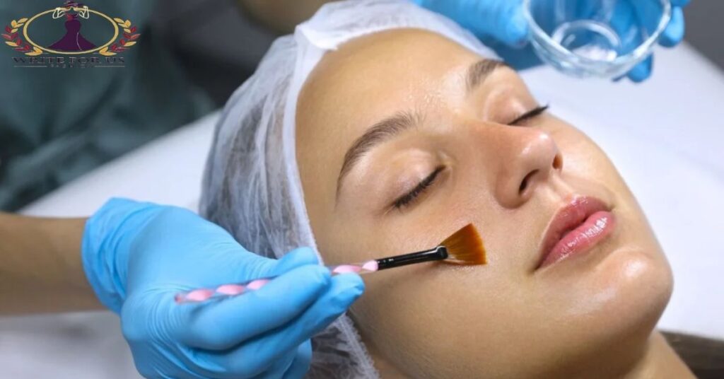 How Yellow Peel Helps Treat Melasma, Age Spots, and Sun Damage